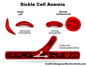 best anemia nclex questions