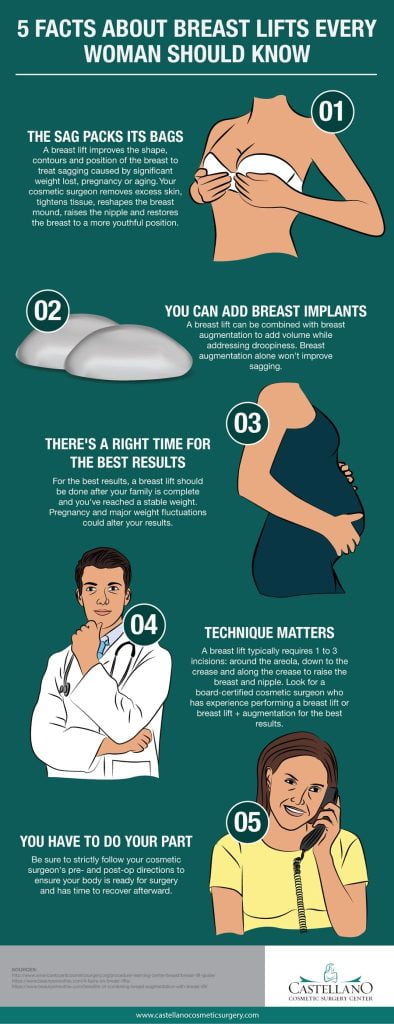 best breast lifts frequently asked questions