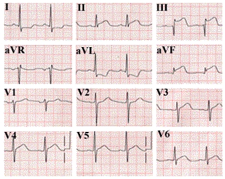 best telemetry exam questions