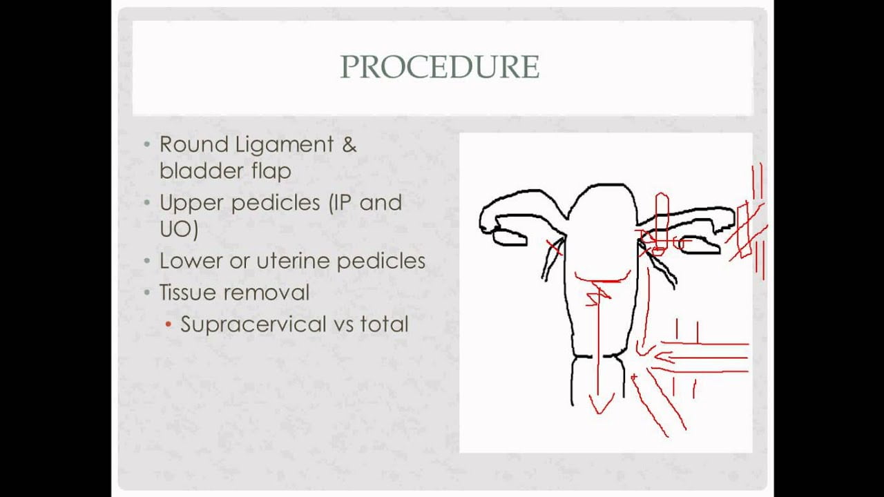 best gyn surgery pimp questions