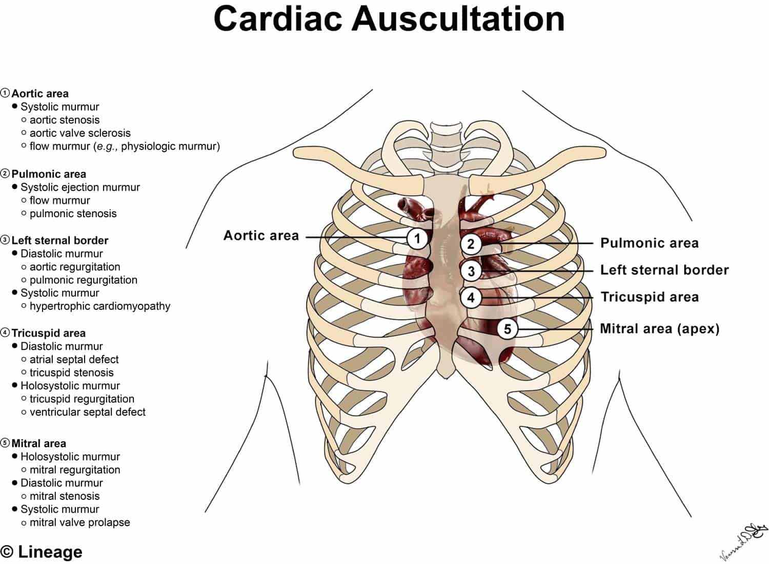 best heart murmur practice questions