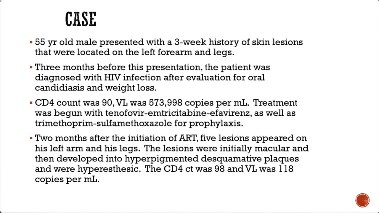 best infectious disease board review questions