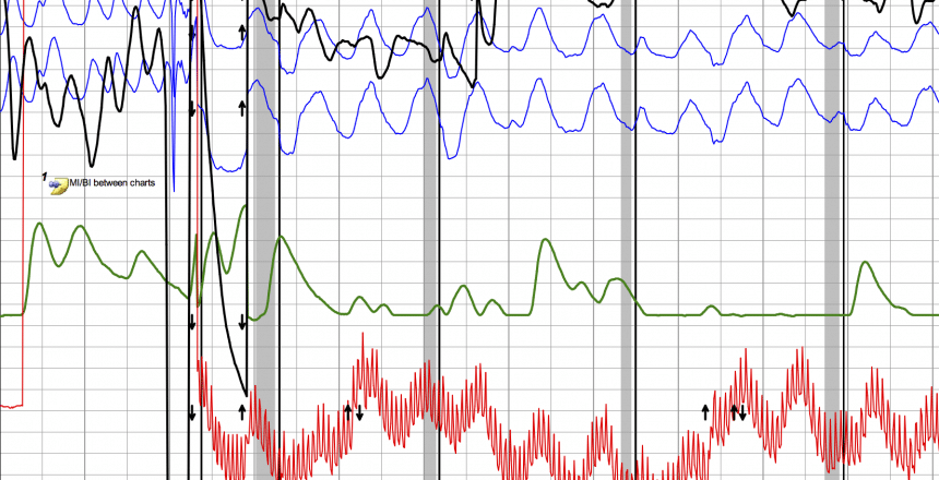 best probation officer polygraph questions