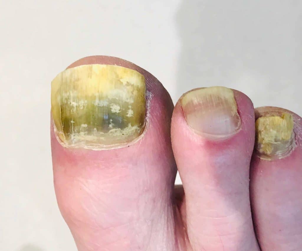 best questions about nails