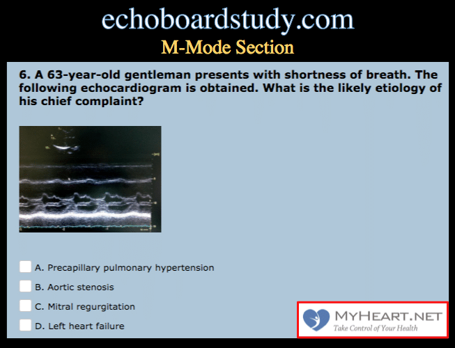 best questions for cardiologist after echocardiogram