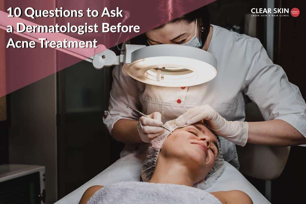 best questions for dermatologist for acne