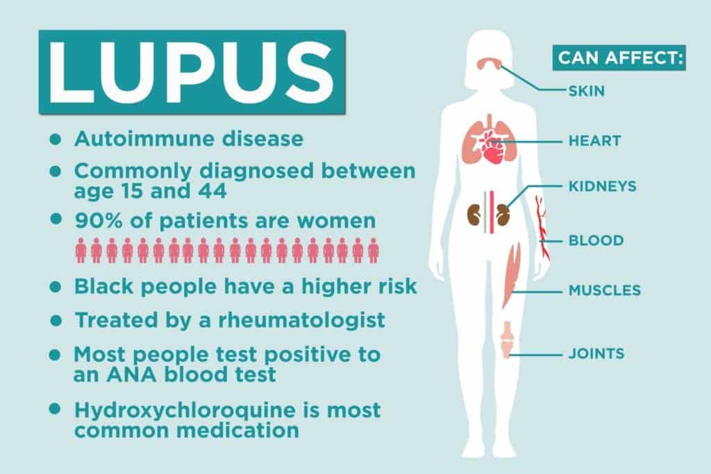 best questions for rheumatologist about lupus