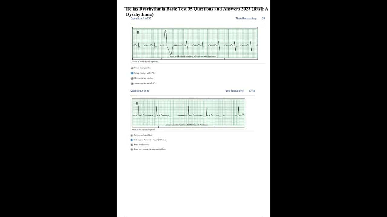 best relias dysrhythmia basic b 35 questions