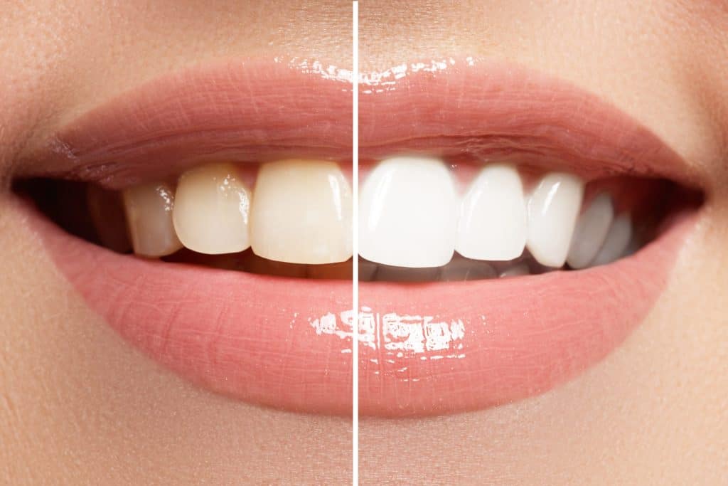 best teeth questions