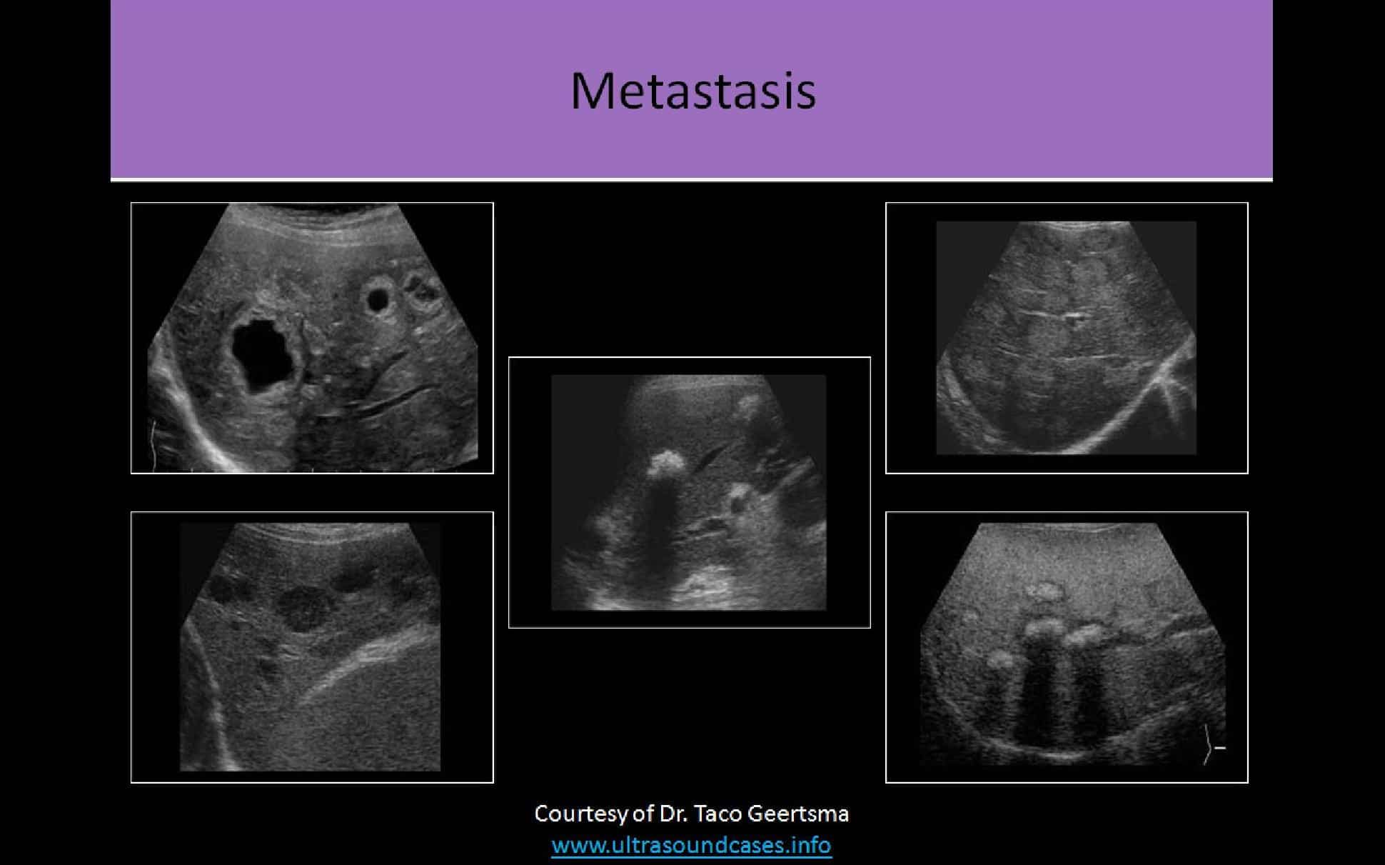 best ultrasound abdomen registry review questions